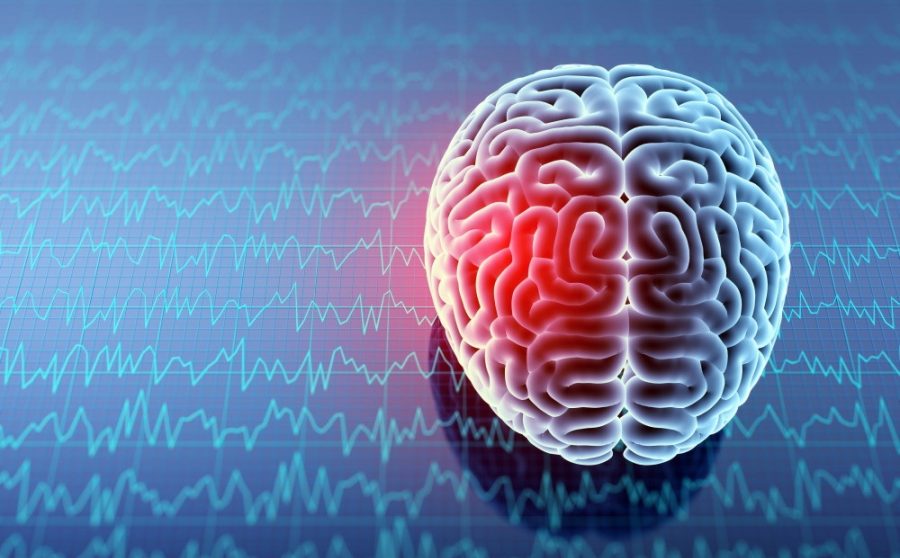 Can You Test How Fit Your Brain Is?